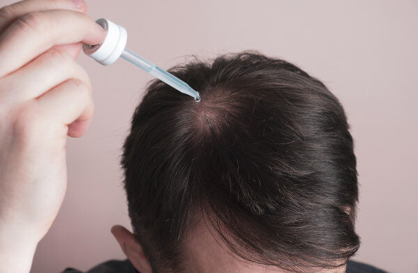 Kirkland Minoxidil 5% 60 ml